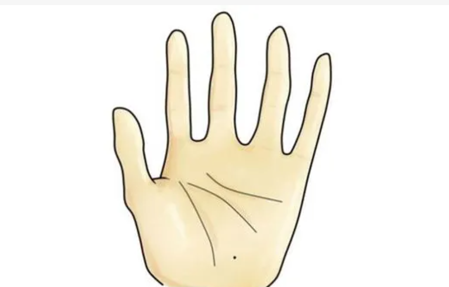 手掌有痣代表的含义是什么（关于手掌有痣的传说）