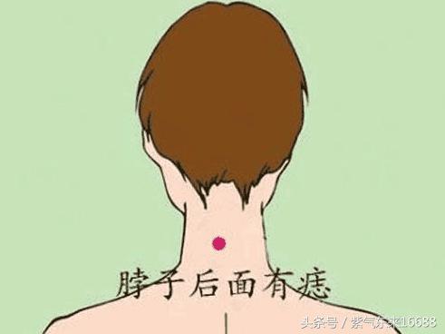 痣相图解：女人脖子上有痣图解