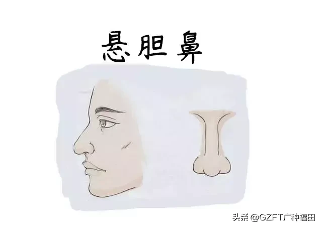 悬胆鼻标准图图片